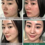 تاثیرات تونر 30 روزه معجزه‌گر AHA.BHA.PHA سام بای می